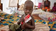 المجاعة تهدد حياة 20 مليون شخص في اليمن وجنوب السودان والصومال وشمال شرق نيجيريا 